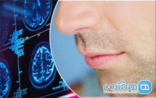 حس بویایی در بیماران کرونایی چندمین روز از بین می رود؟ حس بویایی در بیماران کرونایی چندمین روز از بین می رود؟